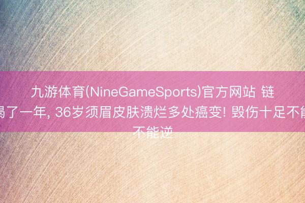 九游体育(NineGameSports)官方网站 链接喝了一年, 36岁须眉皮肤溃烂多处癌变! 毁伤十足不能逆